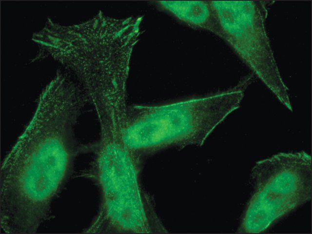 Anti-Palladin antibody produced in rabbit