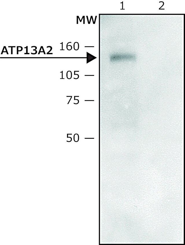 Anti-ATP13A2 (C-terminal region) antibody produced in rabbit