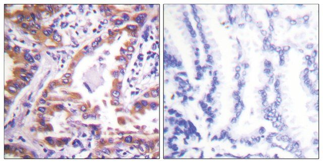 Anti-Calnexin, C-Terminal antibody produced in rabbit