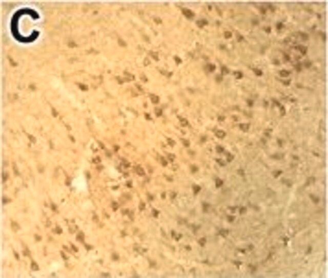 Anti-DNMT3B antibody produced in rabbit
