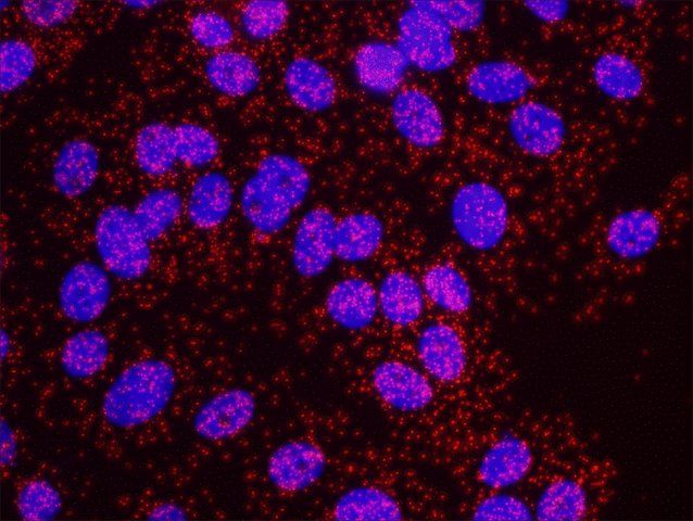 BRCA1 and Estrogen Receptor Alpha PLA<sup>®</sup> Antibody Kit