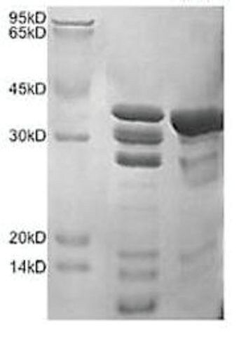 Cathepsin S human