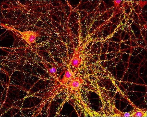 Anti-Mouse IgG (whole molecule)–FITC antibody produced in goat