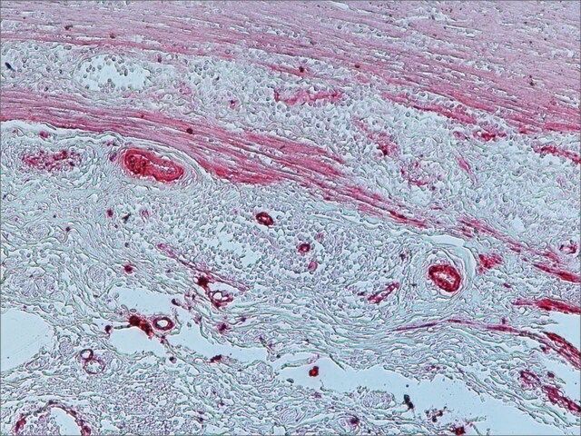 Anti-Mouse IgG (Fc specific)–Alkaline Phosphatase antibody produced in goat