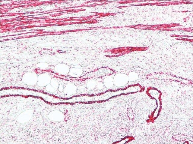 Anti-Mouse IgG (Fc specific)–Alkaline Phosphatase antibody produced in goat