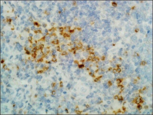 Anti-Human Gamma Heavy Chain antibody, Rabbit monoclonal