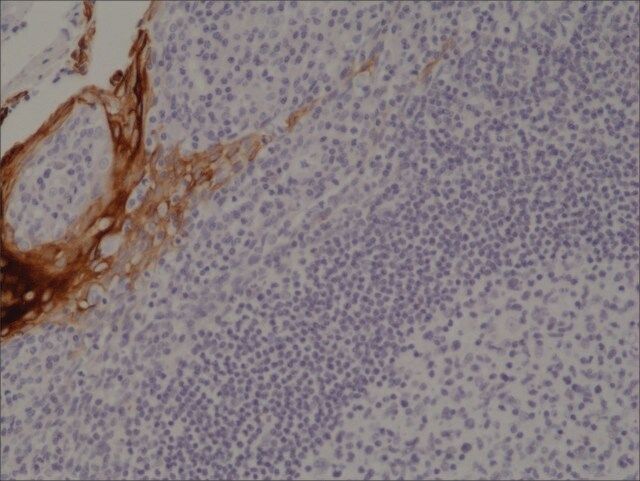 Anti-Cytokeratin 4 (CK-4) antibody, Rabbit monoclonal