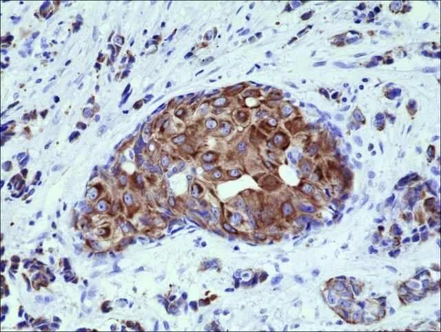 Anti-Cytokeratin 18 antibody, Rabbit monoclonal