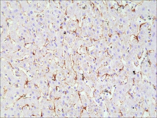 Anti-Caveolin-1 antibody, Rabbit monoclonal