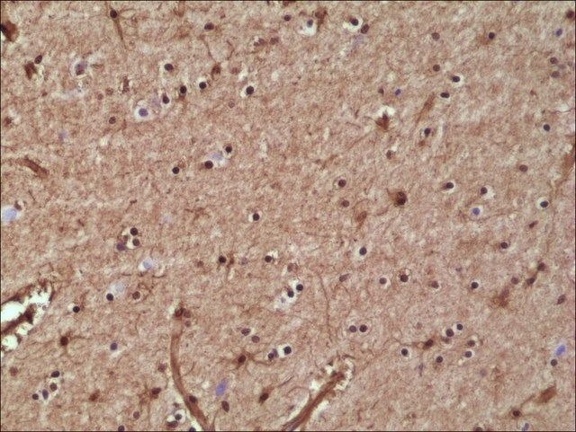 Anti-GST3/GST pi antibody, Rabbit monoclonal