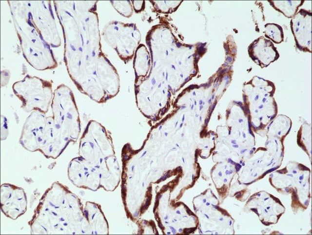 Anti-hCG (Human Chorionic Gonadotropin) antibody, Rabbit monoclonal
