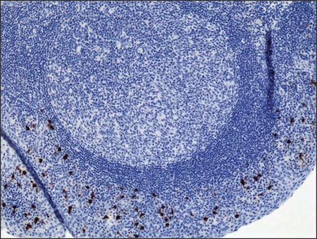 Anti-Human IgA2 antibody, Rabbit monoclonal