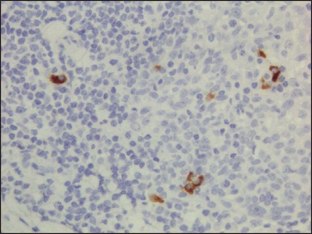 Anti-Human IgG3 antibody, Rabbit monoclonal