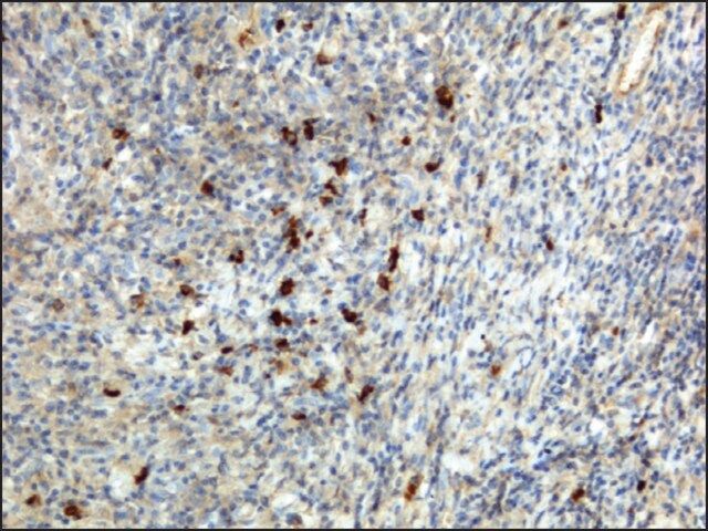 Anti-Human IgA antibody, Rabbit monoclonal