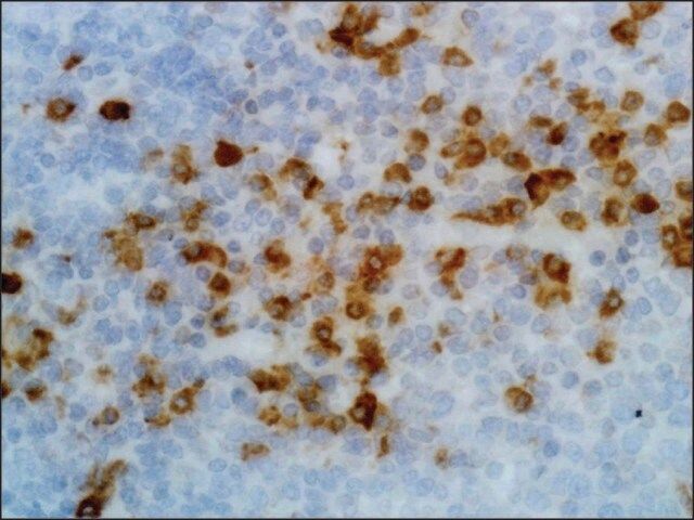 Anti-Human Kappa Light Chain antibody, Rabbit monoclonal