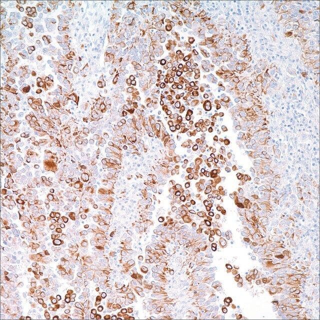 Cytokeratin 5 &6 (D5 &16B4) Mouse Monoclonal Antibody
