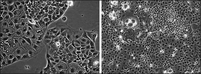 MRP3 Knockout Caco-2 Cells