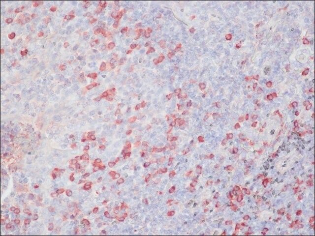 Anti-Chicken IgY (IgG) (whole molecule)-Peroxidase antibody produced in rabbit