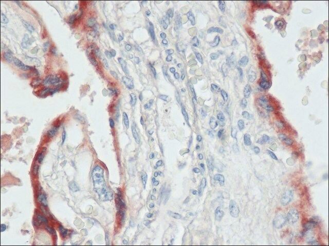 Anti-Chorionic Gonadotropin (α+β subunits) (HCG) antibody produced in rabbit