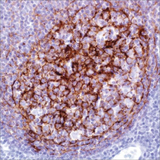 CD21 (2G9) Mouse Monoclonal Antibody