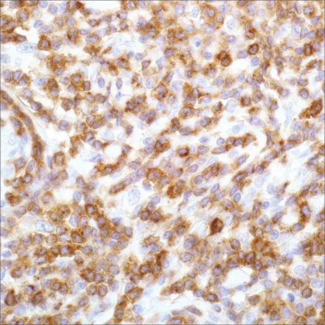 CD7 (EP132) Rabbit Monoclonal Primary Antibody