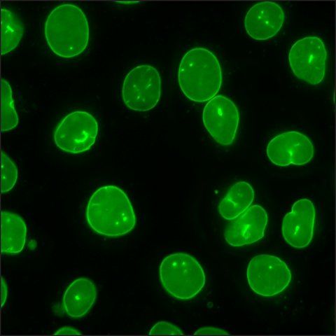 U2OS GFP-LMNB1