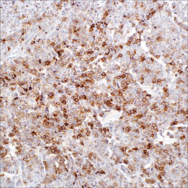 CD25 (4C9) Mouse Monoclonal Antibody