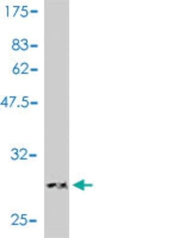 Monoclonal Anti-LAMC1 antibody produced in mouse