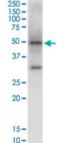 Monoclonal Anti-NSDHL antibody produced in mouse