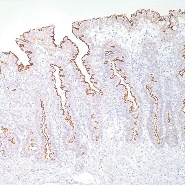 Villin (CWWB1) Mouse Monoclonal Antibody