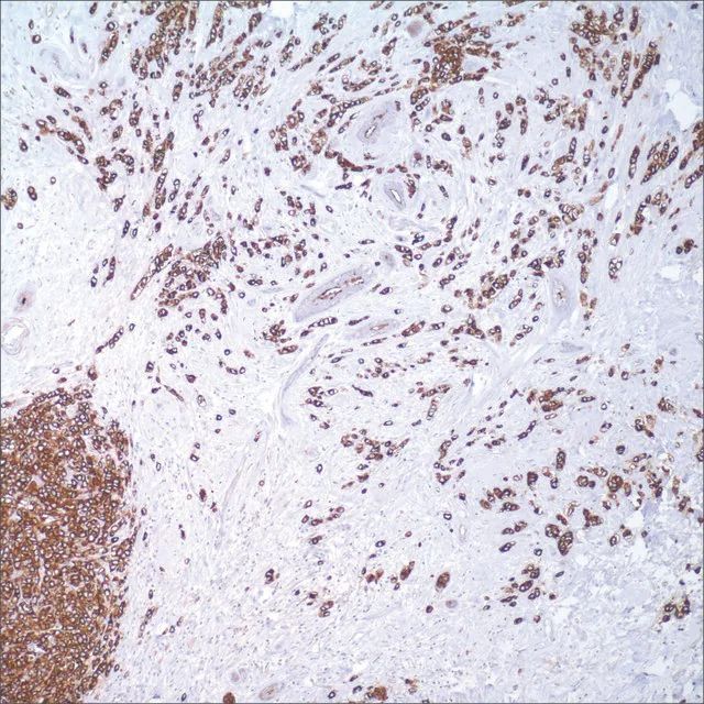 MUC1 (MRQ-17) Mouse Monoclonal Antibody