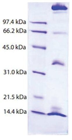Chylomicrons from human plasma