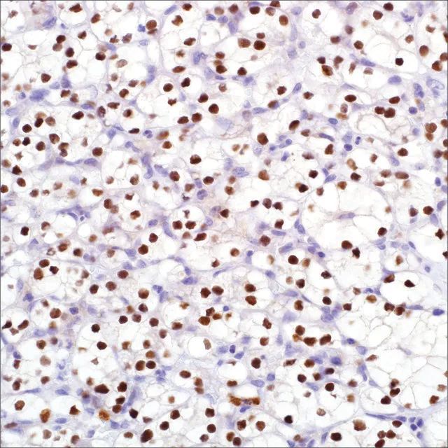 PAX-8 (MRQ-50) Mouse Monoclonal Antibody