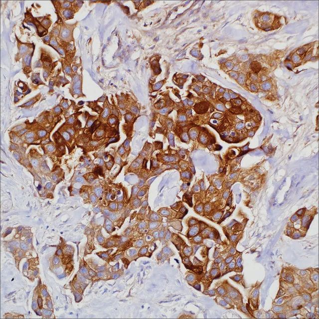 GCDFP-15 (23A3) Mouse Monoclonal Antibody