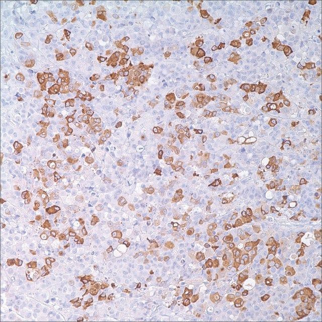 Mammaglobin (31A5) Rabbit Monoclonal Antibody