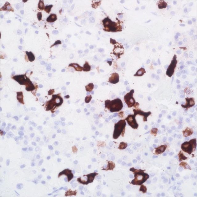 Prolactin (EP193) Rabbit Monoclonal Primary Antibody