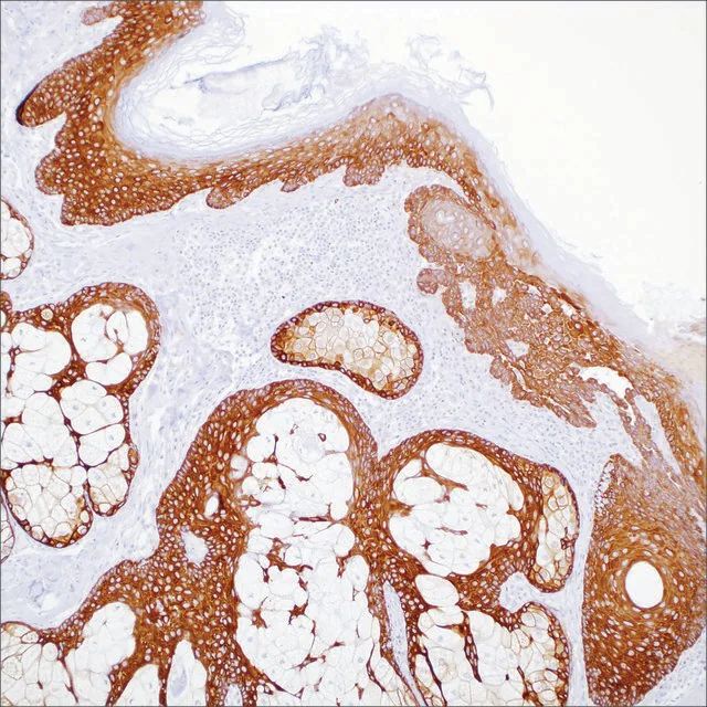 Cytokeratin 5 (EP1601Y) Rabbit Monoclonal Primary Antibody