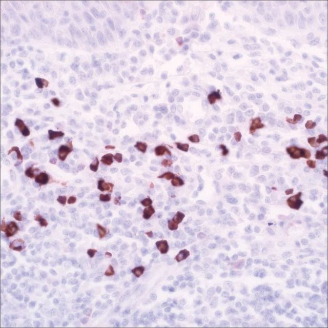 IgG4 (EP138) Rabbit Monoclonal Primary Antibody
