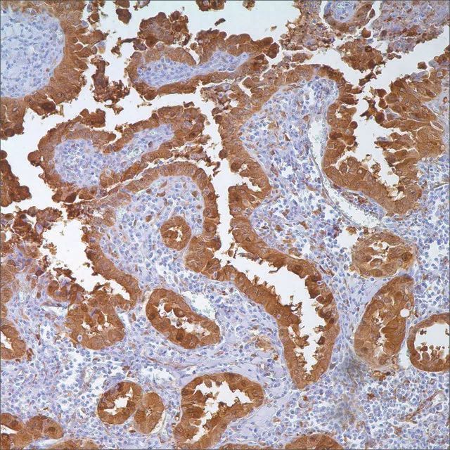 Galectin-3 (9C4) Mouse Monoclonal Antibody