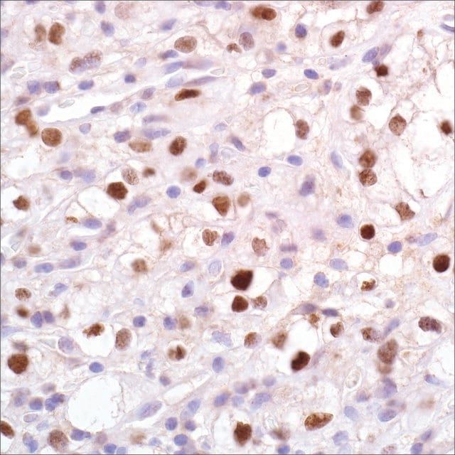 PAX-2 (EP235) Rabbit Monoclonal Primary Antibody
