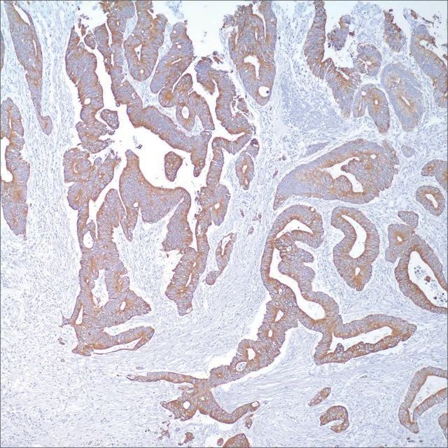 Cytokeratin 20 (Ks20.8) Mouse Monoclonal Antibody