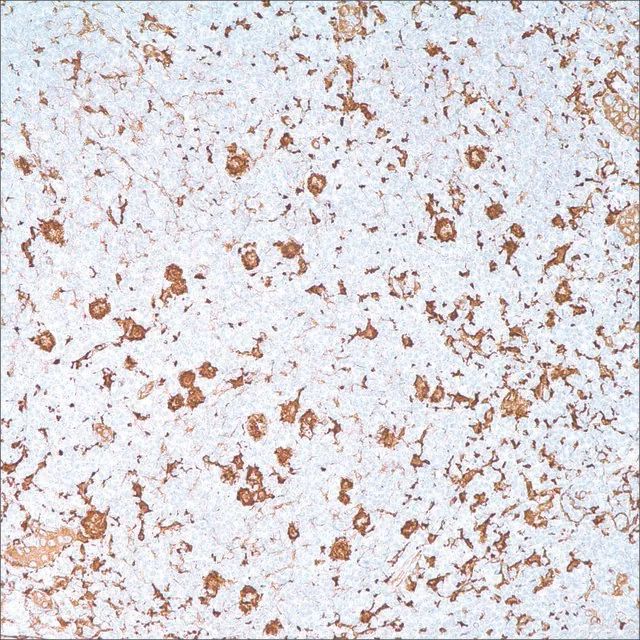 Fascin (55k-2) Mouse Monoclonal Antibody