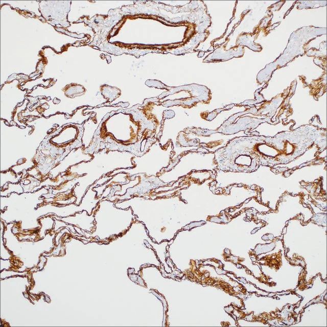 Collagen Type IV (CIV22) Mouse Monoclonal Antibody