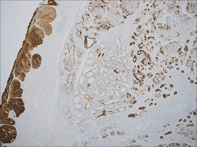 Cytokeratin 5 &6 (EP24 &EP67) Rabbit Monoclonal Primary Antibody