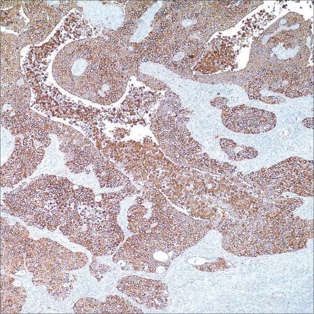 Cytokeratin, HMW (AE3) Mouse Monoclonal Antibody