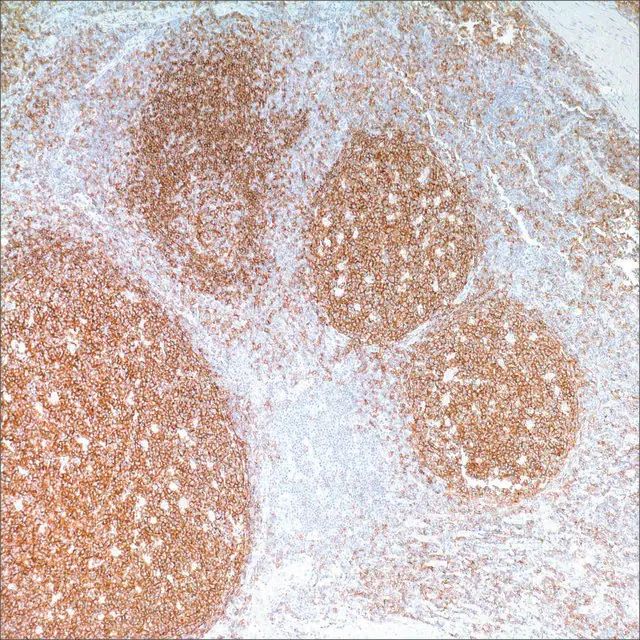 CD19 (MRQ-36) Mouse Monoclonal Antibody