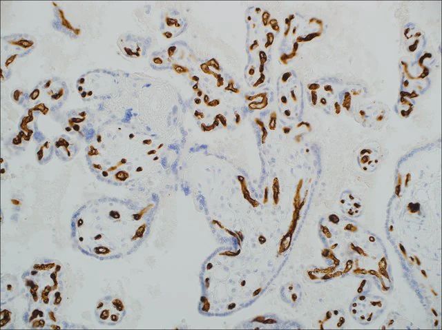 CD34 (EP88) Rabbit Monoclonal Primary Antibody