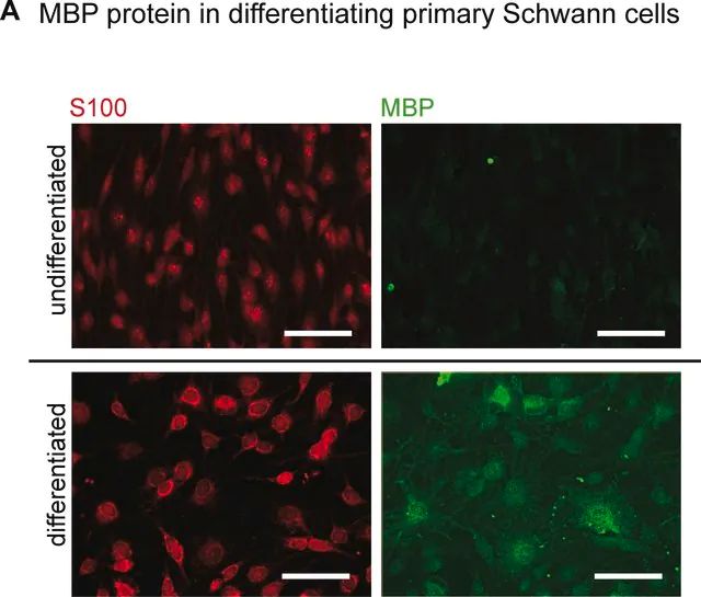 Anti-S-100 Protein Antibody, clone 15E2E2