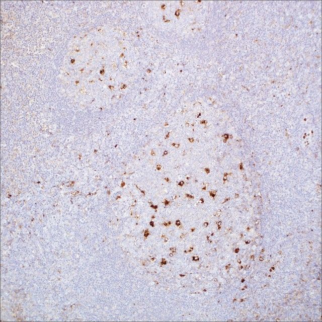 A-1-Antitrypsin Rabbit Polyclonal Antibody