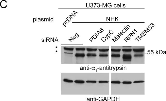 Anti-α<sub>1</sub>-Antitrypsin antibody produced in rabbit